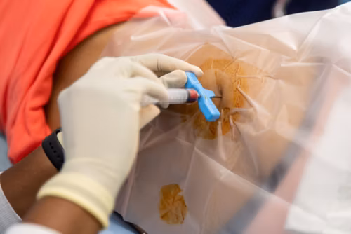 Imagen de biopsia ósea